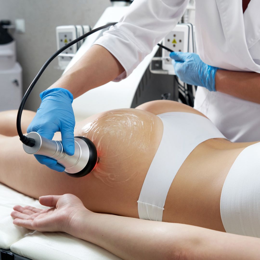 Body Cavitation 1080x1080 2