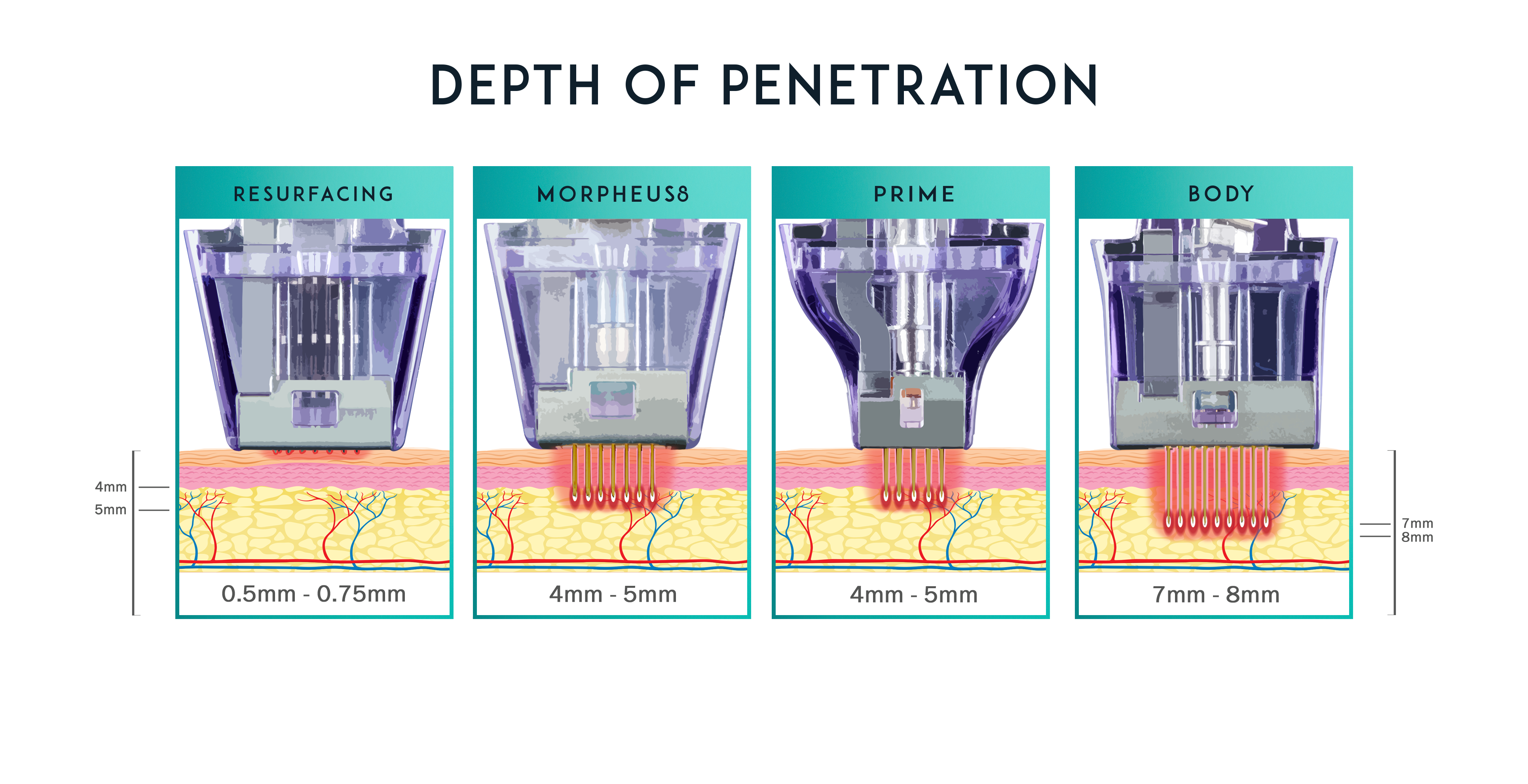 morpheus8-treatment-depths-graphic-preview-1