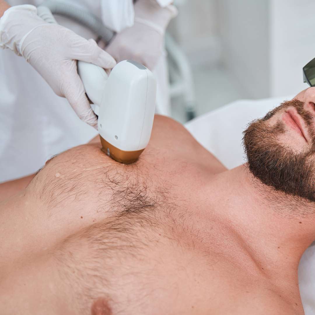 Laser hair removal treatment at Las Vegas Skin Pros