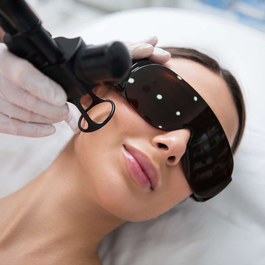 Laser Pore Refinement Therapy Session LVSP LV NV