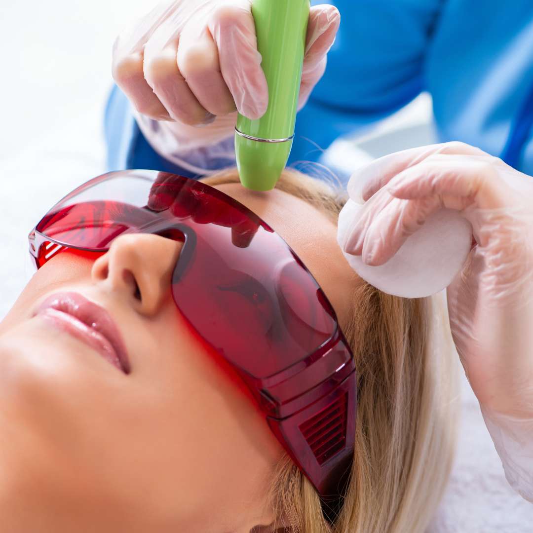 Laser Scar Removal LVSP in Las Vegas
