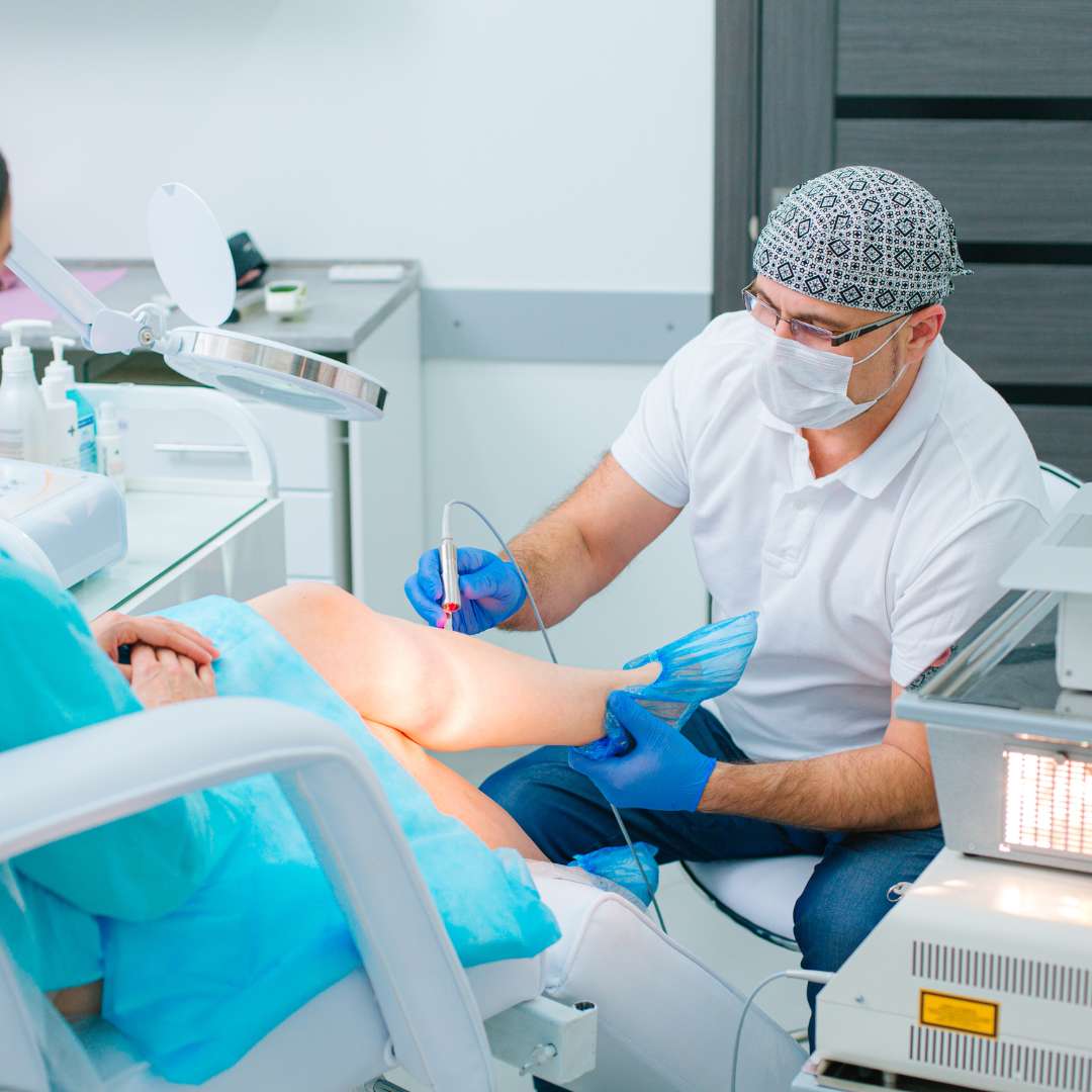Spider Vein Treatment at Las Vegas Skin Pros Procedure