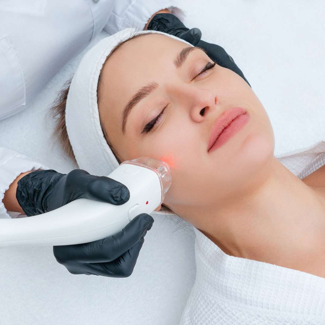 Venous Lake Treatment at Las Vegas Skin Pros Face Treatment