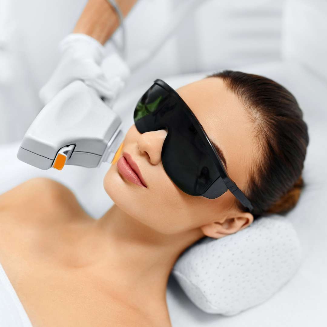 How is the procedure performed for IPL Skin Tone Pigment Correction