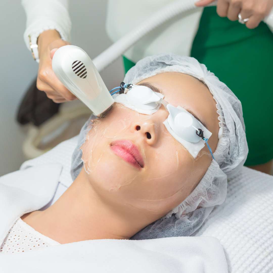 What is IPL Skin Tone Pigment Correction What is IPL Skin Tone Pigment Correction