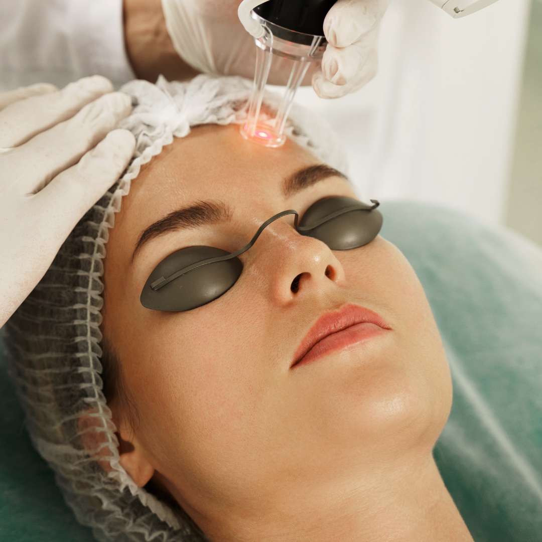 Whats The DownTime for Skin Resurfacing Radiant Renewal
