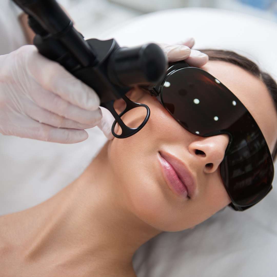 Acne Laser at Las Vegas Skin Pros Acne Laser at Las Vegas Skin Pros