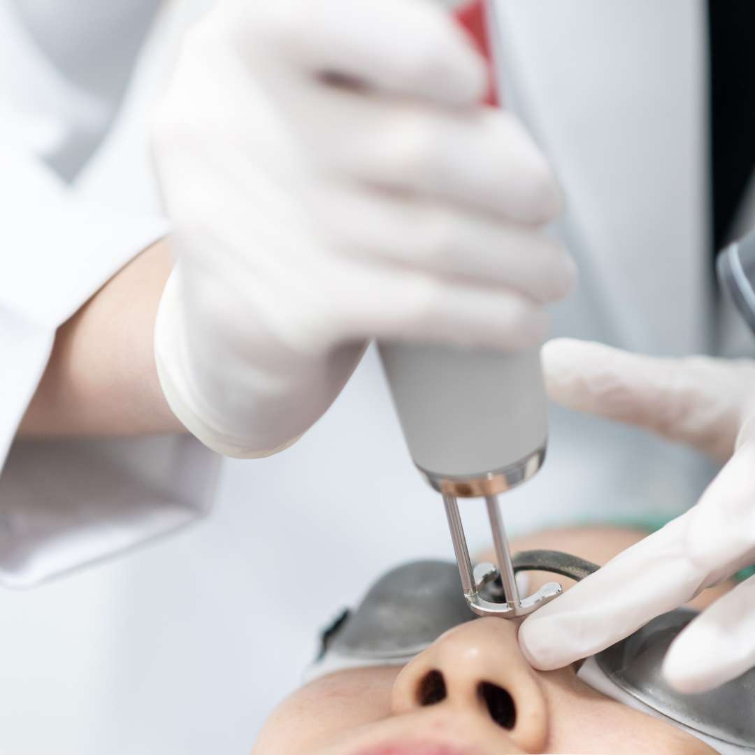 CO2 Laser Treatment Las Vegas Skin Pros