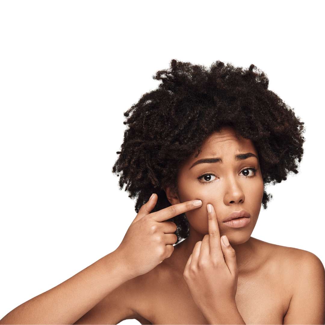 Clarifying Acne Facial Before and After at Las Vegas Skin Pros Clarifying Acne Facial Before and After at Las Vegas Skin Pros